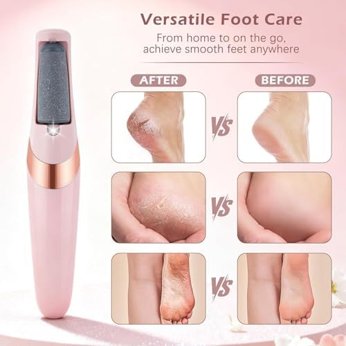Rechargeable Foot Callus Remover With 1 Extra Head | Foot Pedi | Grinder For Soft Skin | Find Back Feet Care