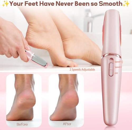 Rechargeable Foot Callus Remover With 1 Extra Head | Foot Pedi | Grinder For Soft Skin | Find Back Feet Care